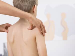 Faszientherapie an den Schultern bei einem Kind